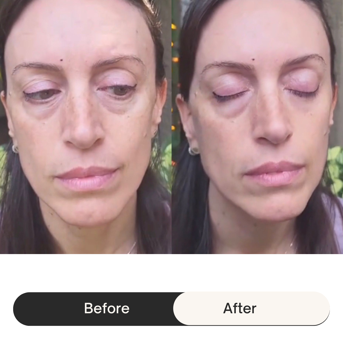 HEMIODERM - Instant Lift - Anti-Aging