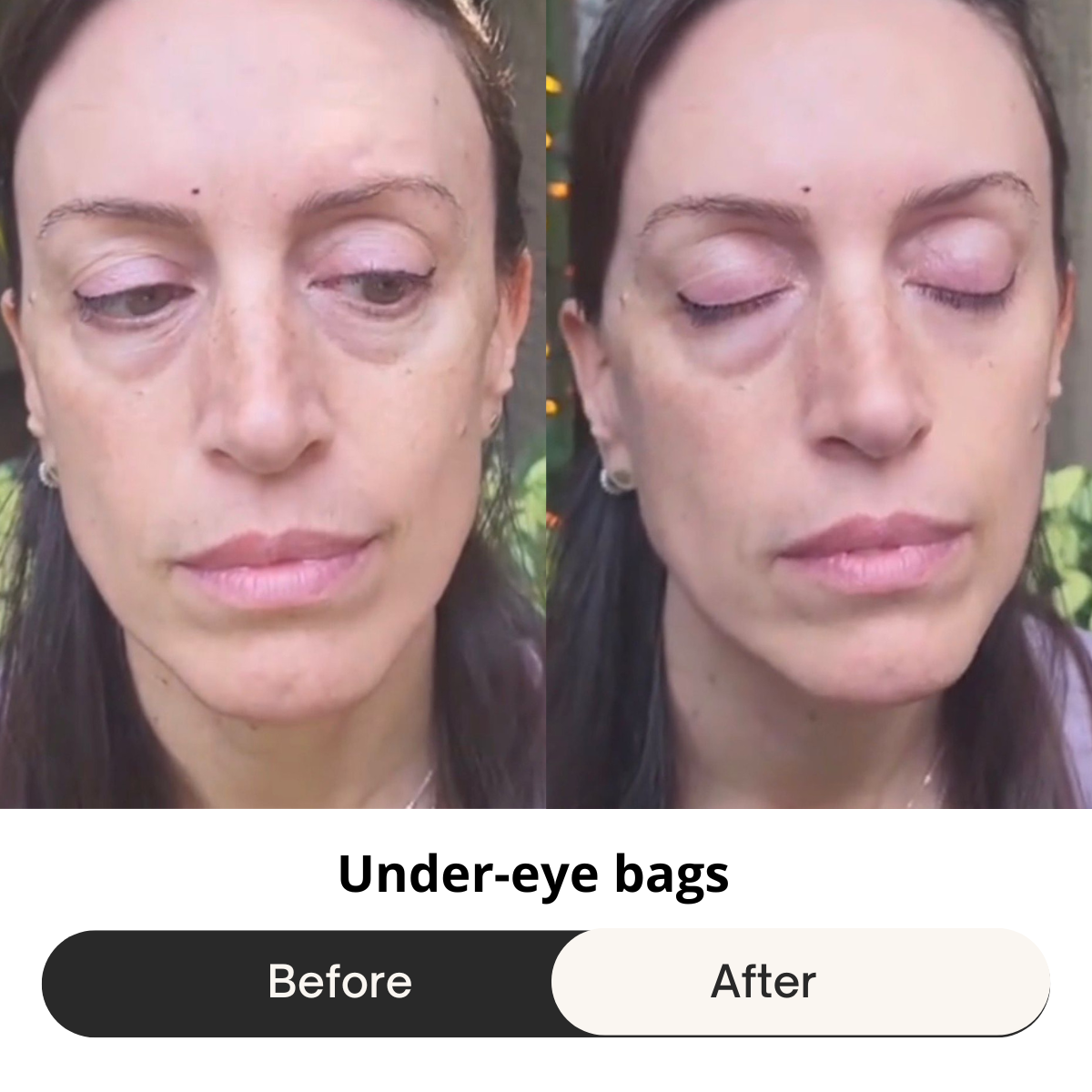 HEMIODERM - Instant Lift - Anti-Aging